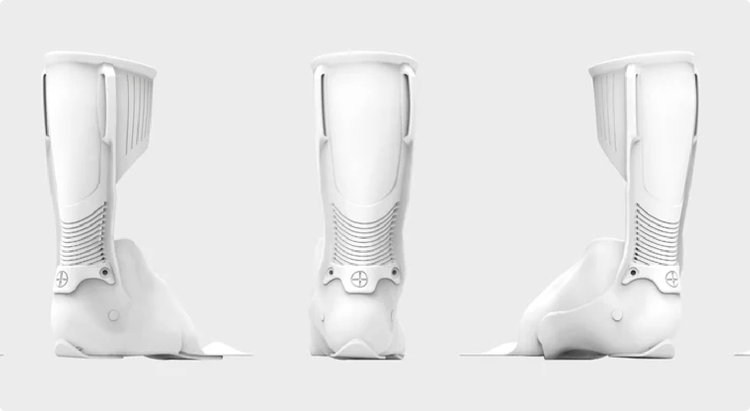 Series Production of Custom Foot Orthoses